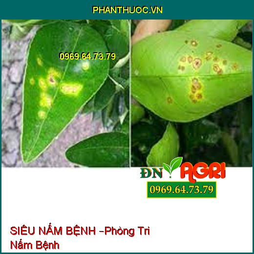 SIÊU NẤM BỆNH –Phòng Tri Nấm Bệnh