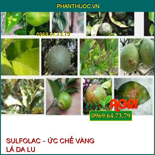 SULFOLAC – ỨC CHẾ VÀNG LÁ DA LU