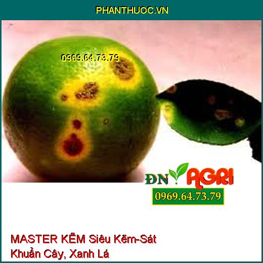 MASTER KẼM Siêu Kẽm - Sát Khuẩn Cây, Giúp Cây Xanh Lá, Cứng Cây