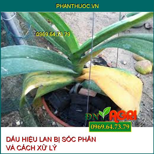 DẤU HIỆU LAN BỊ SỐC PHÂN VÀ CÁCH XỬ LÝ